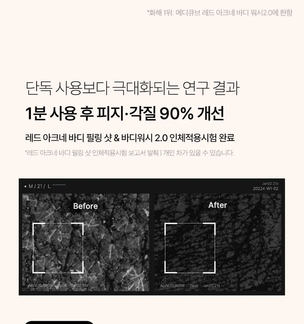 [NEW/바디트러블 케어] 메디큐브 레드 아크네 바디 필링 샷 110g 상세페이지 35